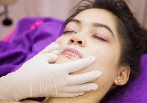 Quy trình thực hiện xăm môi - Ủ Tê