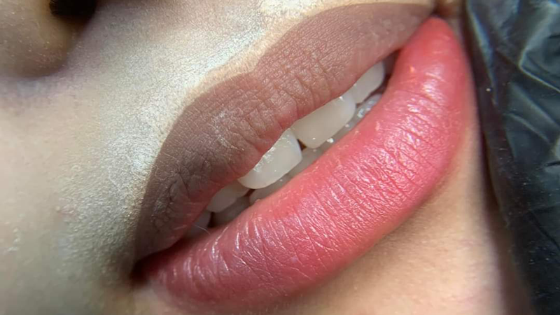 Thoát khỏi nỗi ám ảnh môi thâm, rạng rỡ đón nắng với phun xăm khử thâm môi