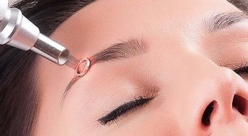 Vì sao nên lựa chọn cách xóa xăm lông mày vĩnh viễn bằng Laser