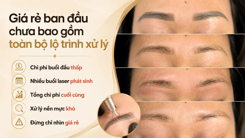 Giá rẻ ban đầu thường chưa bao gồm những chi phí nào? Giá rẻ ban đầu thường chưa bao gồm những chi phí nào?