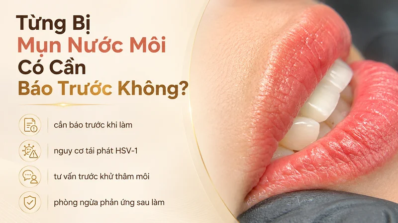 Hãy báo trước tất cả tình trạng môi của bạn để KTV nắm kỹ và tư vấn chính xác Hãy báo trước tất cả tình trạng môi của bạn để KTV nắm kỹ và tư vấn chính xác