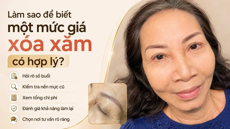Làm sao để biết một mức giá xóa xăm có hợp lý? Làm sao để biết một mức giá xóa xăm có hợp lý?