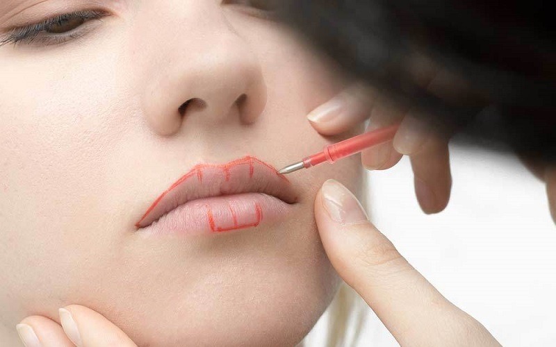 Những trường hợp cần dặm lại môi lần 2