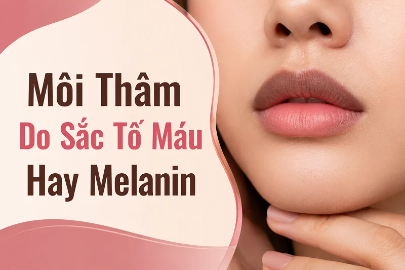 Môi Thâm Do Sắc Tố Máu Hay Melanin? Hiểu Đúng Trước Khi Khử Thâm Môi