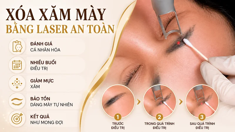 Xóa xăm chân mày bằng laser là gì và hoạt động như thế nào? Xóa xăm chân mày bằng laser là gì và hoạt động như thế nào?