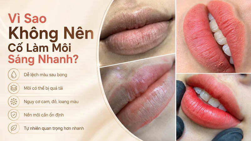 Vì sao khử thâm môi không nên cố làm nhanh trong 1 lần. Vì sao khử thâm môi không nên cố làm nhanh trong 1 lần.