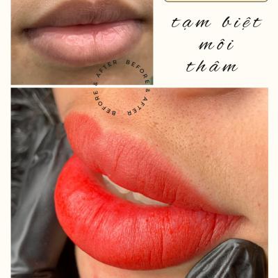 LuxLIP, khử thâm môi nữ