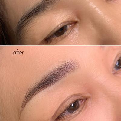 Phẩy sợi kết hợp phun hạt mịn